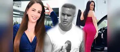 Melissa Klug se sometió a cirugía estética Melissa Klug se somete a radical cambio físico tras separarse de Jesús Barco: "Ya me verás"