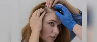 Nanosomas son pequeñas vesículas lipídicas capaces de encapsular principios activos y liberarlos directamente en el área donde más se necesitan. Nanosomas capilares: la nueva nanotecnología que regenera el cabello con resultados visibles en una semana