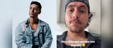 Patricio Quiñones aparece en redes y revela enfermedad en la piel. Patricio Quiñones revela que padece una enfermedad incurable: “Hay días que no son tan buenos”