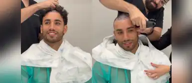 Said Palao se rapa por salud y cuenta su intervención capilar realizada en Madrid. Said Palao se rapa todo el cabello para someterse a un trasplante capilar en Madrid: “Toca confiar en el proceso”