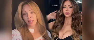 Sheyla Rojas habla de sus procedimientos estéticos Sheyla Rojas impacta al confesar que piensa revertir sus retoques estéticos: “Me había puesto tanto ácido hialurónico”