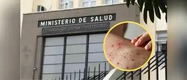 Minsa emite alerta epidemiológica ante alto riesgo de importación y transmisión de sarampión y polio en el país. Minsa emite alerta epidemiológica por alto riesgo de transmisión de sarampión y polio: conoce medidas preventivas