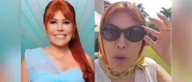 Magaly Medina habló sobre su cirugía. Magaly Medina RESPONDE sin pelos en la lengua sobre su cirugía: “Mi cara es mi mayor inversión”