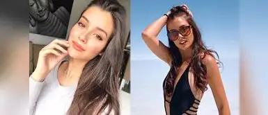 La modelo tenía una trayectoria de 15 años antes de sufrir el ACV. Modelo revela cómo un ACV cambió su vida y hoy enfrenta rechazo en castings: "Ya no me eligen"