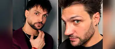Nicola Porcella nueva nariz Nicola Porcella DEJA EN SHOCK a fans al lucir su NUEVA NARIZ tras su cuarta cirugía: "No es el resultado final"
