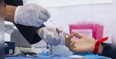 Prueba rápida de VIH gratis: Conoce los puntos de despistaje este 1 de diciembre por el Día Mundial contra el SIDA