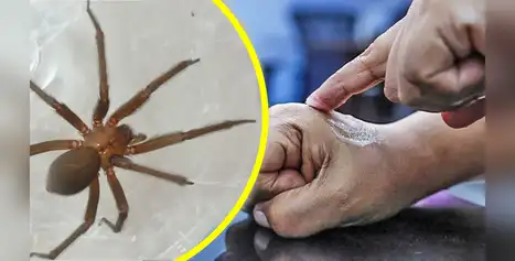 Niño muere en Ucayali por mordedura de araña casera: cómo identificarla y qué hacer ante una mordedura