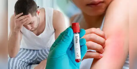 Sífilis alcanza récord de contagios en Perú: Especialistas advierten los SÍNTOMAS SILENCIOSOS que muchos ignoran