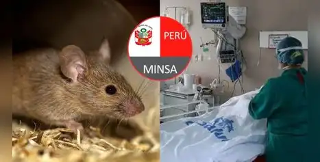 Minsa confirma 3 fallecidos y 841 casos de contagios a nivel nacional por leptospirosis: ¿Cómo reconocer sus síntomas?