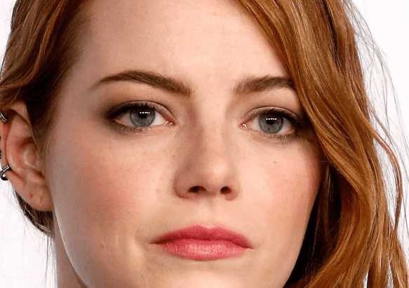 Emma Stone Se Rompe El Hombro Durante Concierto De Las Spice Girls