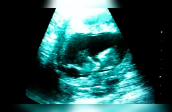 Esta ecografía demostraría qué es lo que los bebés hacen en el vientre de su madre. wapa.pe
