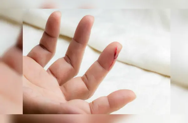 ¿Por qué cuando nos cortamos con papel nos duele tanto? wapa.pe