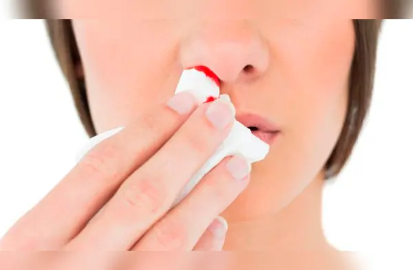 Esta es la razón por la que aún no hay tratamiento para la hemofilia. (Foto: Redes Sociales) wapa.pe