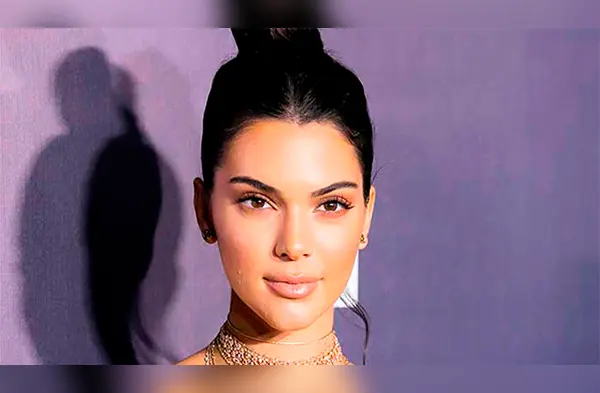 Estas son las características de las pieles mixtas wapa.pe