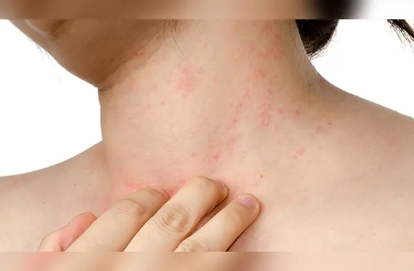 Recuerda consultar a un especialista si el malestar persiste. wapa.pe