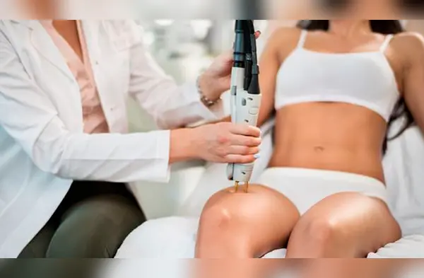 No es recomendable realizarse la depilación a láser en meses de verano debido a la exposición solar. wapa.pe