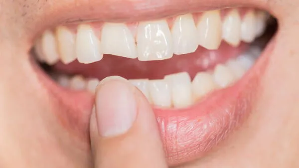 Científicos japoneses descubren cómo hacer crecer los dientes nuevamente
