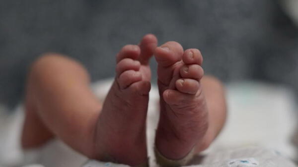 Nacimiento de bebé con tres miembros viriles impacta al mundo