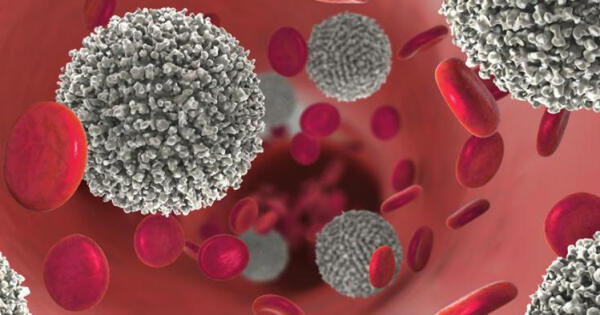 Las personas con cáncer de la sangre pueden no estar protegidas de forma óptima tras la vacunación con COVID-19