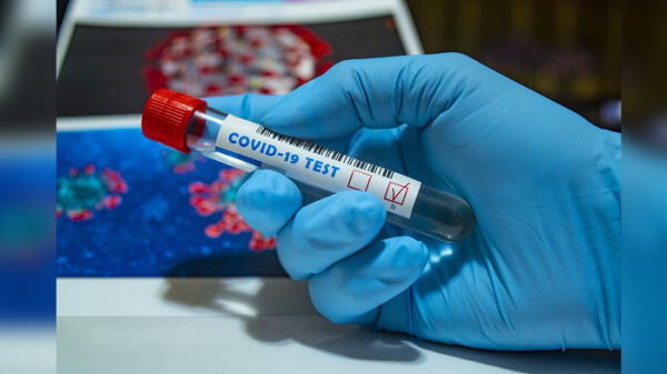 Científicos estudian fármaco para acabar con el coronavirus