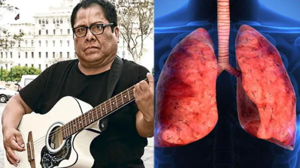 Perú: Hernán Condori Cachuca revela que sufre de fibrosis pulmonar tras infectarse de coronavirus