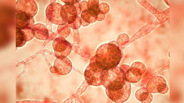Candida auris hongo resistente a los antibióticos que amenaza a la recuperación de contagiados con coronavirus