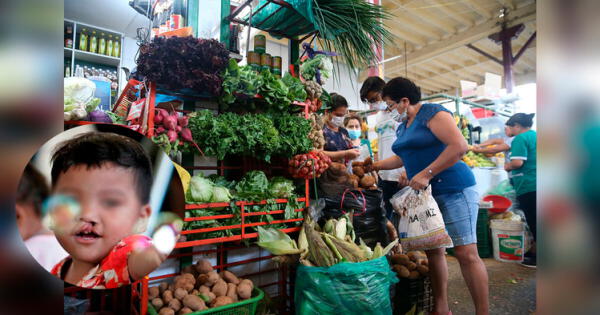 Cómo alimentar a un bebé con paladar hendido