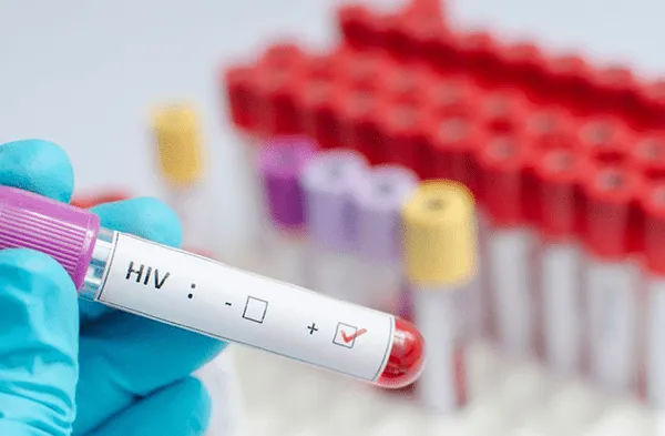 Vacuna contra el VIH: Fracasa ensayo de fármaco contra virus de la inmunodeficiencia humana de Johnson & Johnson en África fotos