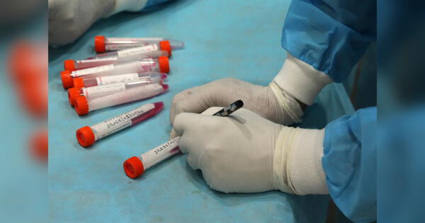 COVID-19 Reino Unido: Clausuran un laboratorio británico tras detectar que procesó erróneamente pruebas de coronavirus
