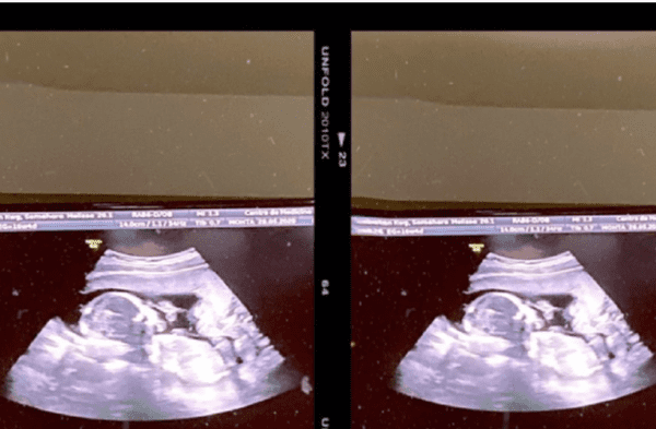 pareja demanda a clínica de fertilidad tras dar a luz a bebé ‘equivocado’
