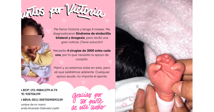 Mamá de Victoria necesita 30 mil soles para operar a la bebé