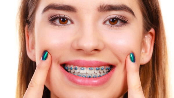 Soñar con brackets se interpreta como la búsqueda de una solución inmediata.