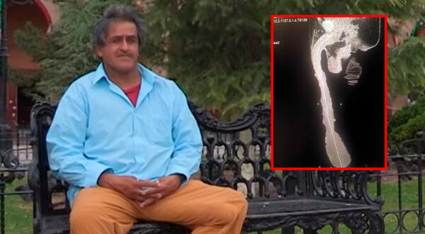 Roberto Esquivel no disfruta tener el pene más largo del mundo