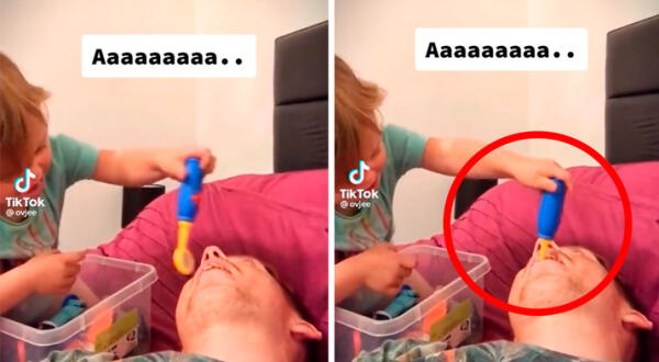 Niño juega al dentista con su papá y casi termina en tragedia wapa.pe