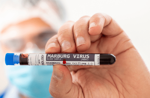 virus de marburgo