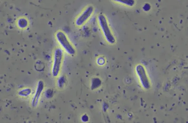 bacterias resistentes