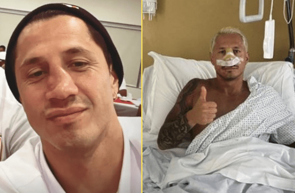 Gianluca Lapadula se somete a cirugía de nariz y revela su temor a una nueva fractura