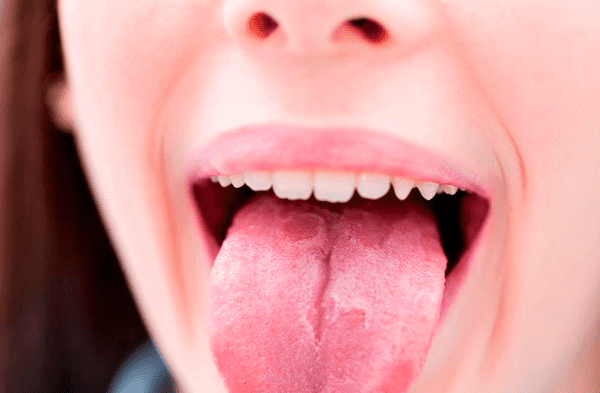 ¿Por qué me muerdo la lengua o dentro de la boca seguido cuando mastico?