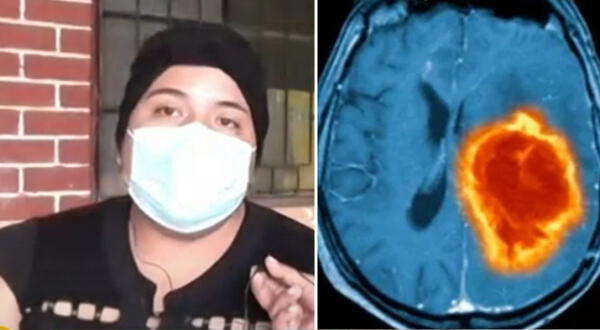 Madre peruana con cáncer avanzado pide ayuda para no dejar desamparados a sus cuatro hijos: "Puedo curarme"