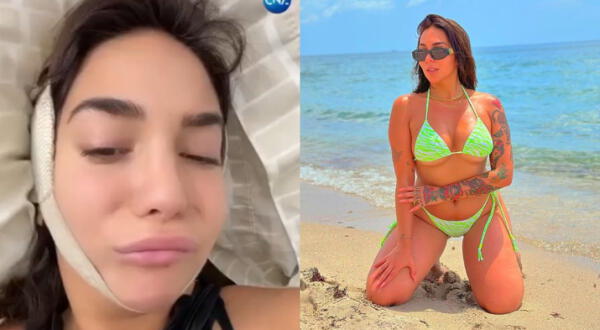 Famosa modelo se somete a cirugías estéticas tras críticas a su cuerpo y termina con parálisis wapa.pe