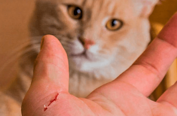 Rabia humana: ¿Es posible contagiarme por la mordedura o arañazo de un gato?