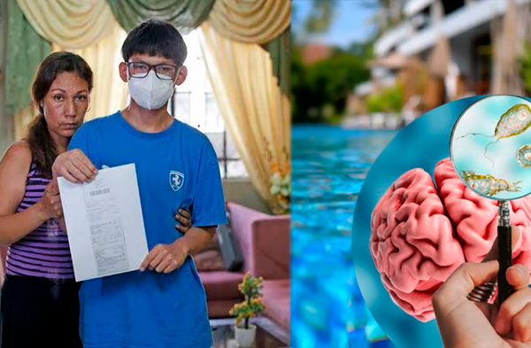 Adolescente de 17 años contrajo ameba “comecerebros” tras ingresar a piscina en paseo familiar