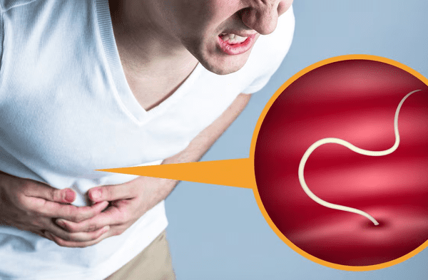 Parásitos en el intestino. wapa.pe