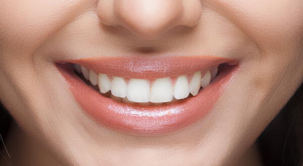 La acumulación de sarro con el tiempo puede desarrollar enfermedades bucales. wapa.pe