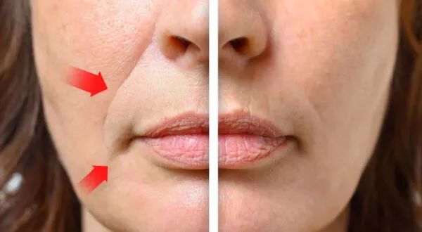 Sábila para líneas de expresión en la boca: cómo aplicarla y aprovecharla wapa.pe