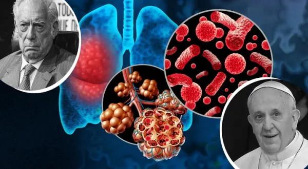 Los peligros de la neumonía: la silenciosa enfermedad que se llevó al Papa Francisco, Mario Vargas Llosa y otros grandes del mundo wapa.pe