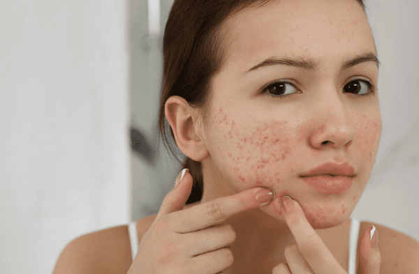 Estas son las causas ocultas y cuándo debes correr al dermatólogo. wapa.pe