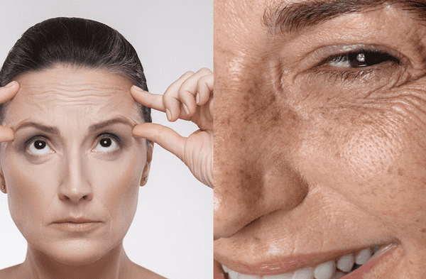 Tips casero para eliminar las líneas de expresión wapa.pe