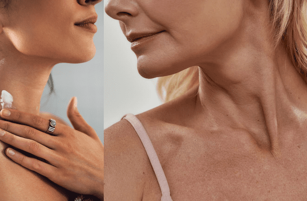 7 cremas que rejuvenecen cuello y escote wapa.pe