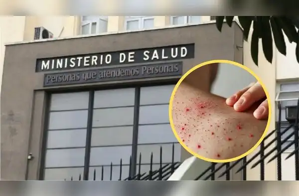 Minsa emite alerta epidemiológica ante alto riesgo de importación y transmisión de sarampión y polio en el país. wapa.pe